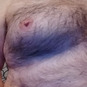 Alf1