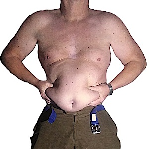 Mastschwein