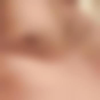 Ich69