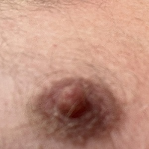 Posucht
