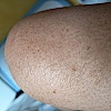 BertiBC