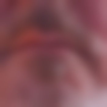 neunkirchen47843