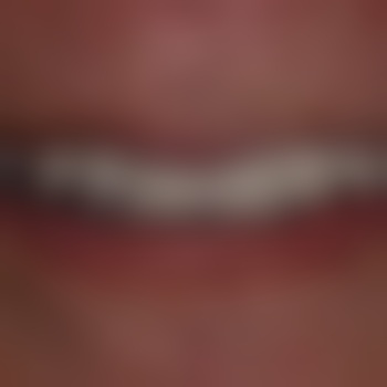 Bialter